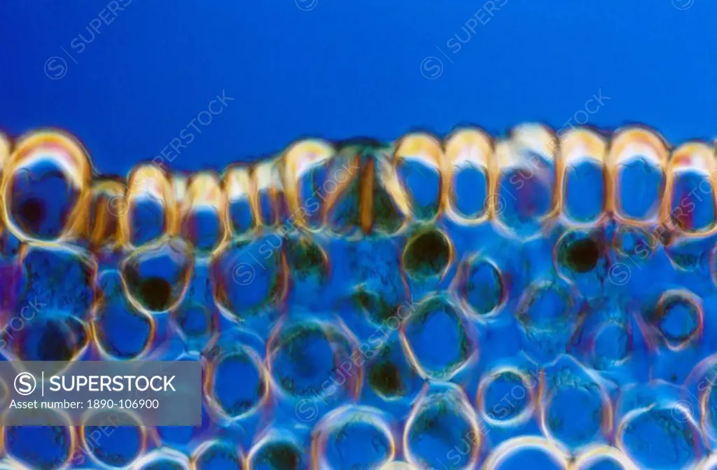 Light Micrograph LM of a transverse section of a stem of Whisk Fern Psilotum nudum, magnification x 1200