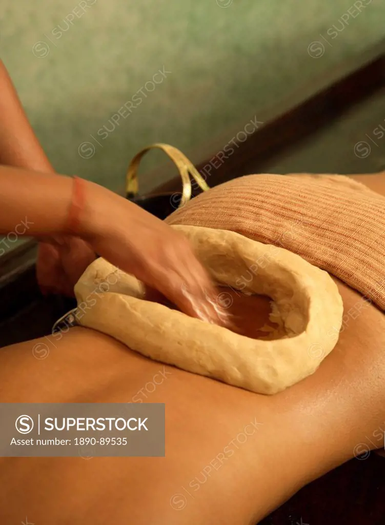 Kathi Vasti Treatment, an Ayurvedic procedure retaining warm medicated oil over the lower back within a border of herbal paste