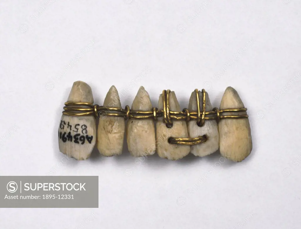 Copy of a denture consisting of six ivory teeth bound with gold wire. The original was excavated at Sidon, situated in modern Lebanon, in 1802, and is...