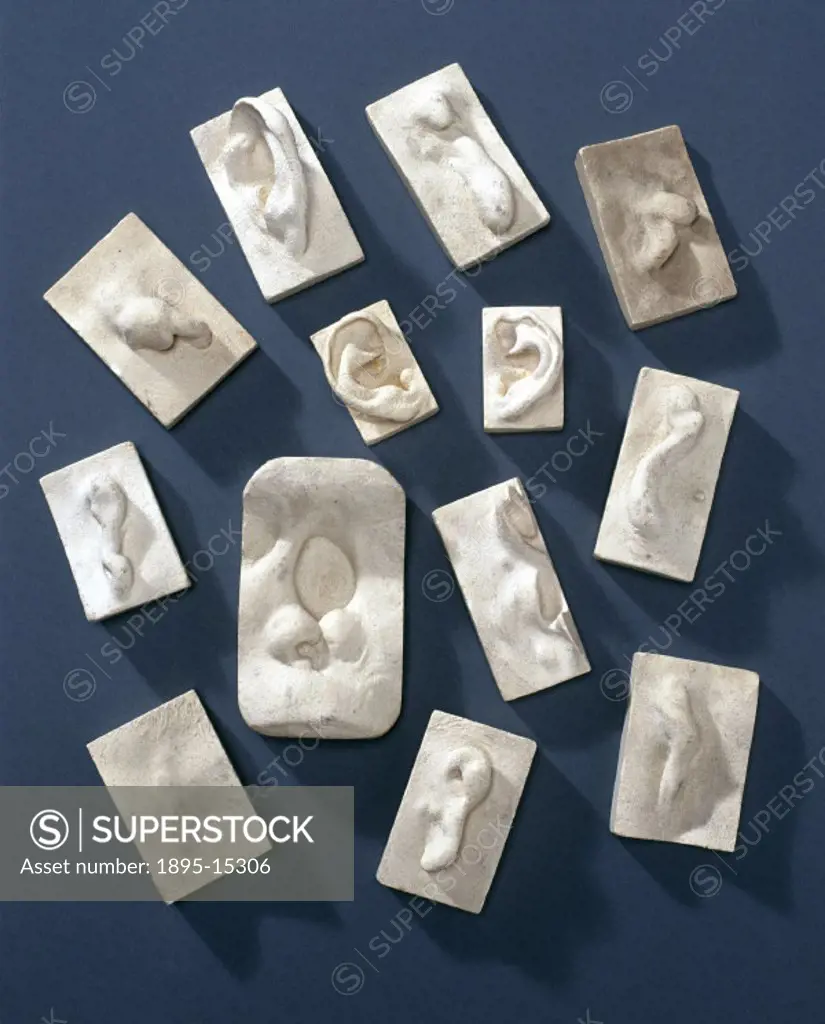 Examples from a collection of plaster casts of diseased ear, nose and throat (ENT) organs, originally owned by Mr Claude Woakes, made by H Brook of Su...