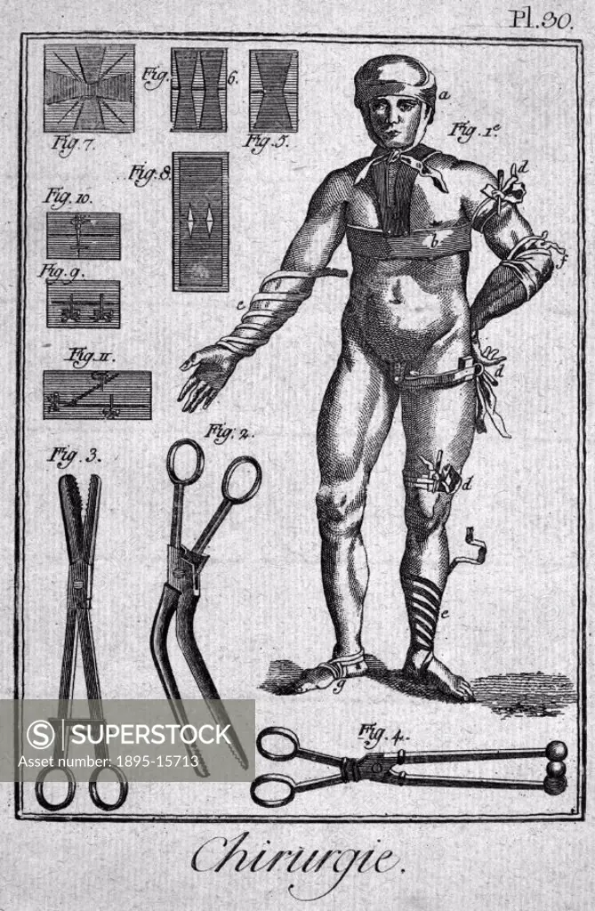 Engraving entitled Chirurgie’ (Surgery), from the 1780 quarto edition of ´La Grande Encyclopedie, ou Dictionnaire Raisonne de Science, des Arts et de...