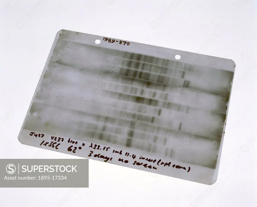 An autoradiograph of the first genetic fingerprint prepared by Alec Jeffreys at Leicester University on 19 September 1984. Jeffreys was the first to d...
