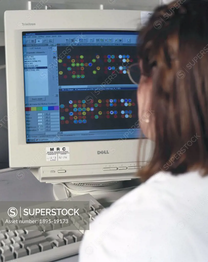 A scientist from the human genome mapping project at the Medical Research Council in Cambridge analysing DNA microarrays. Microarrays are used to anal...