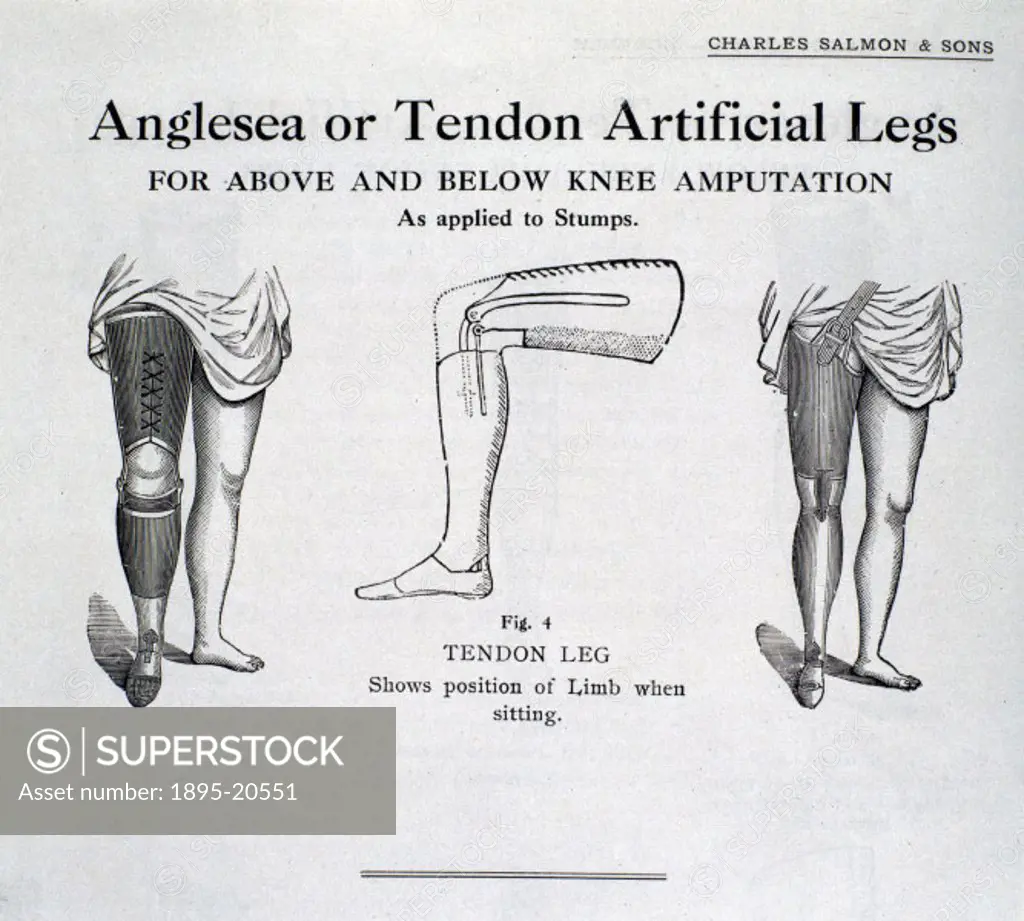 Illustrated plate taken from a trade catalogue of Charles Salmon & Sons, London, showing artificial legs made for above and below the knee amputations...