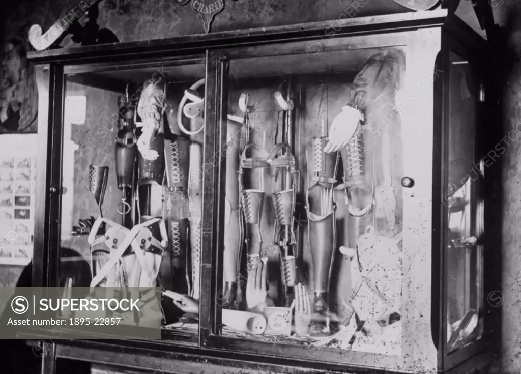 Photograph of a glass cabinet containing artificial arms, legs, hands and orthopaedic corsets.  All of the items were manufactured by James Gillingham...