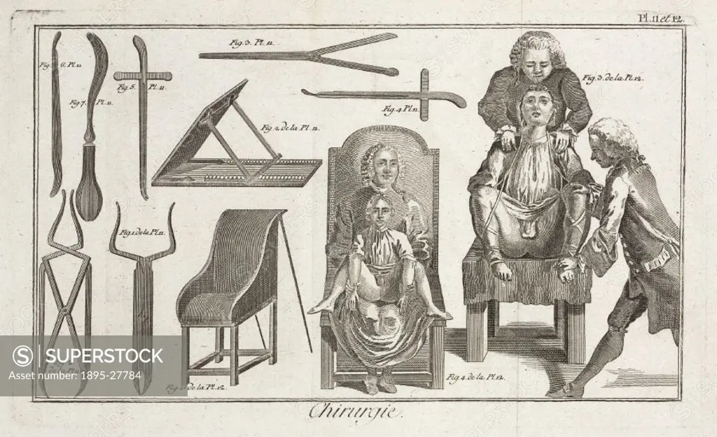 Plates 11 and 12, entitled ´Chirurgie´, (Surgery), showing surgical instruments and scenes of surgical procedures from the 1780 quarto edition of ´La ...
