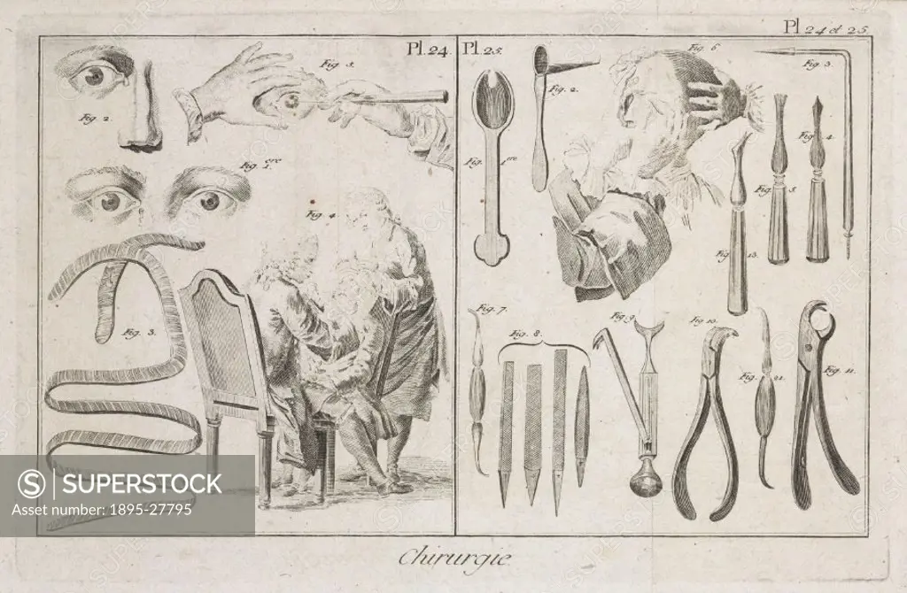 Plate 24 and 25 entitled Chirurgie’ (Surgery), showing surgical instruments from the 1780 quarto edition of ´La Grande Encyclopedie, ou Dictionnaire ...