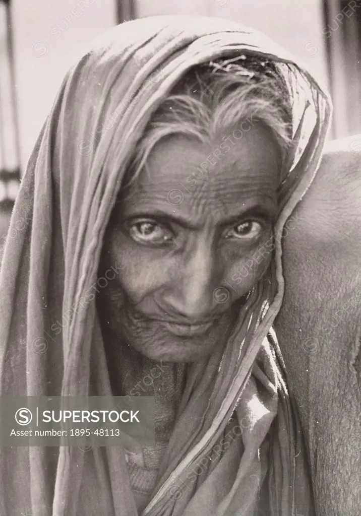 The partly blind wife of a beggar, East Pakistan, 1963.Gelatin silver print. After the partition of India, the new countries of East and West Pakistan...
