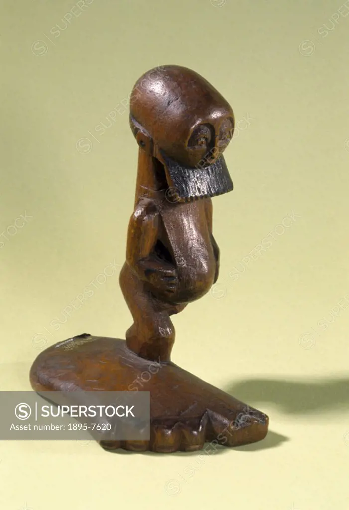 This effigy, possibly made by a member of the Basonge tribe, is of a one-legged man with a gigantic foot, which may represent Elephantoid Hypertrophy ...