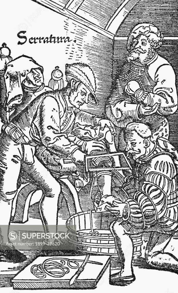 Sixteenth century amputation.