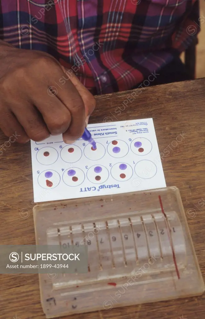 BLOOD SAMPLES, COTE DIVOIRE. Vicinity Daloa, Guediboua village. Blood samples being tested using a chemical agent which indicates blood infected with parasites causing sleeping sickness. . 