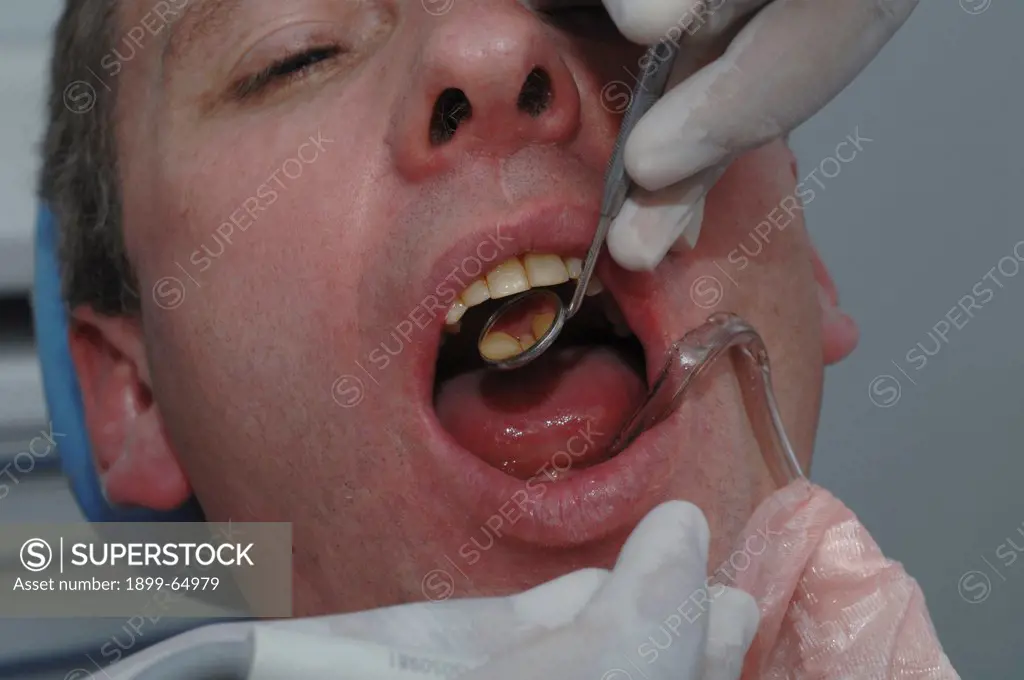 Dentist using dental mirror to exam condition of patients