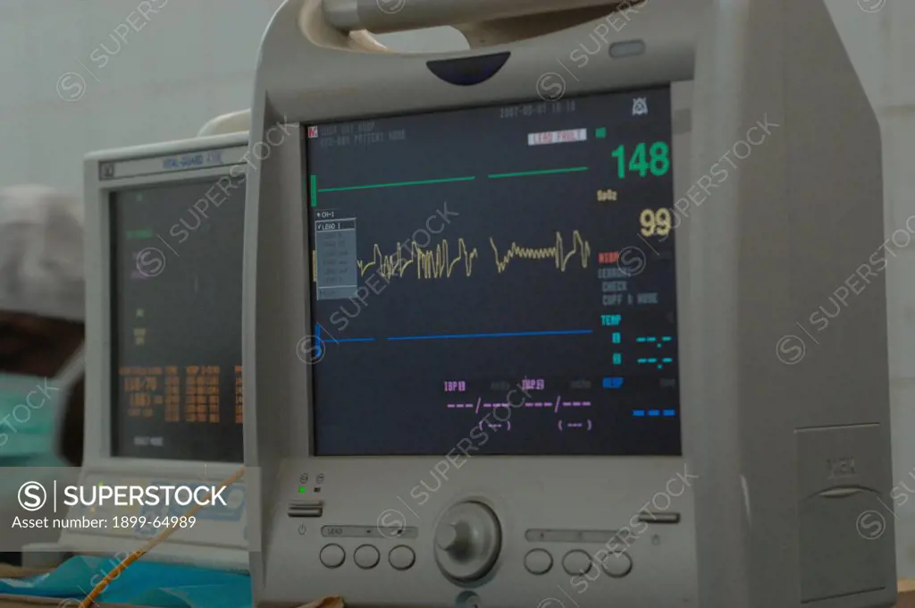 Vital signs monitor during operation