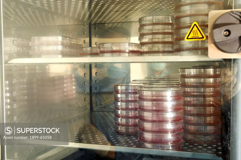 Induced pluripotent stem cells in laboratory fridge