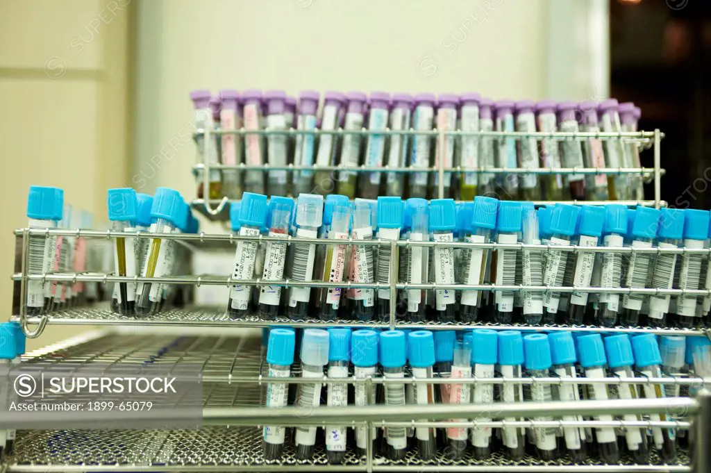Rack of sample tubes containing blood for analysis