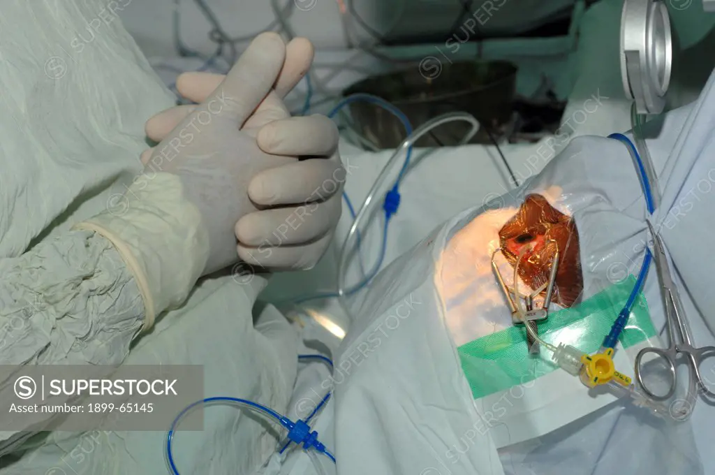 Surgeon's gloved hands near patient's eye,
