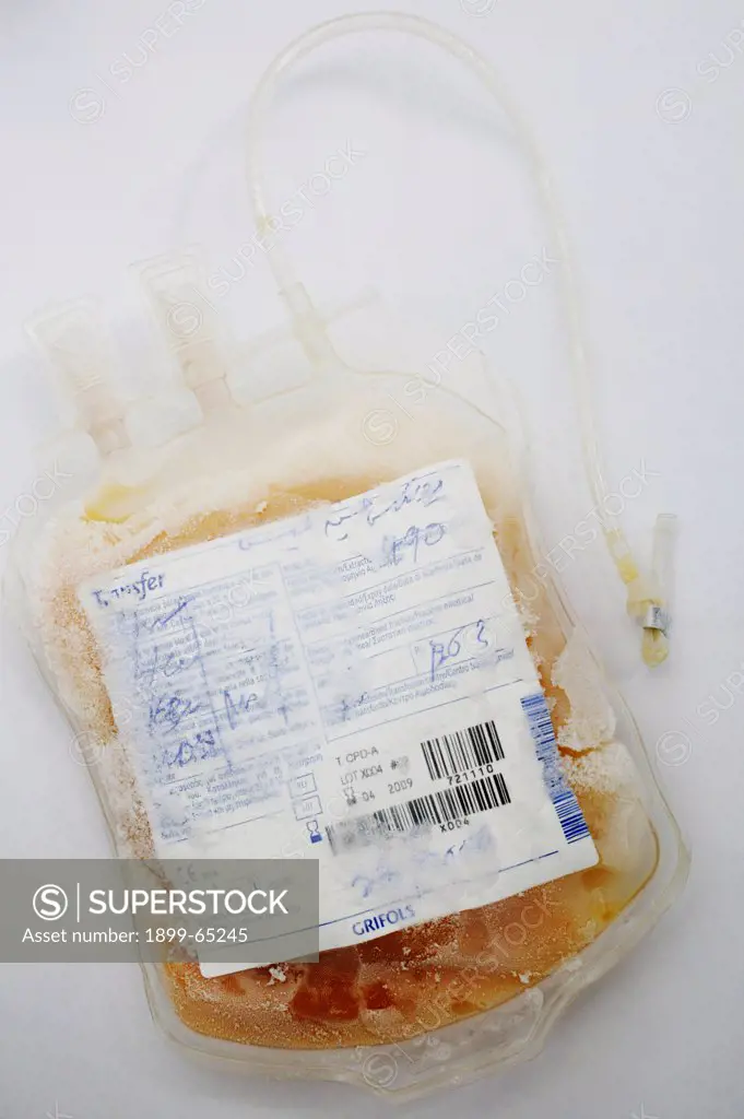 Fresh frozen plasma (FFP) in blood bag