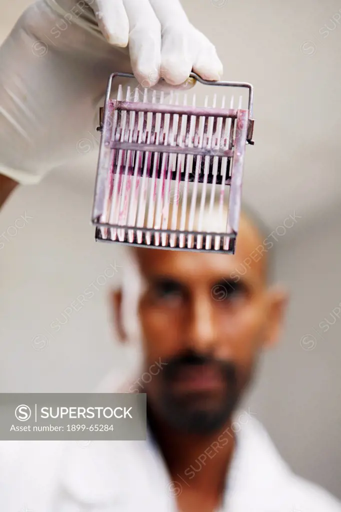 Pathologist holding up dyed set of sample slides