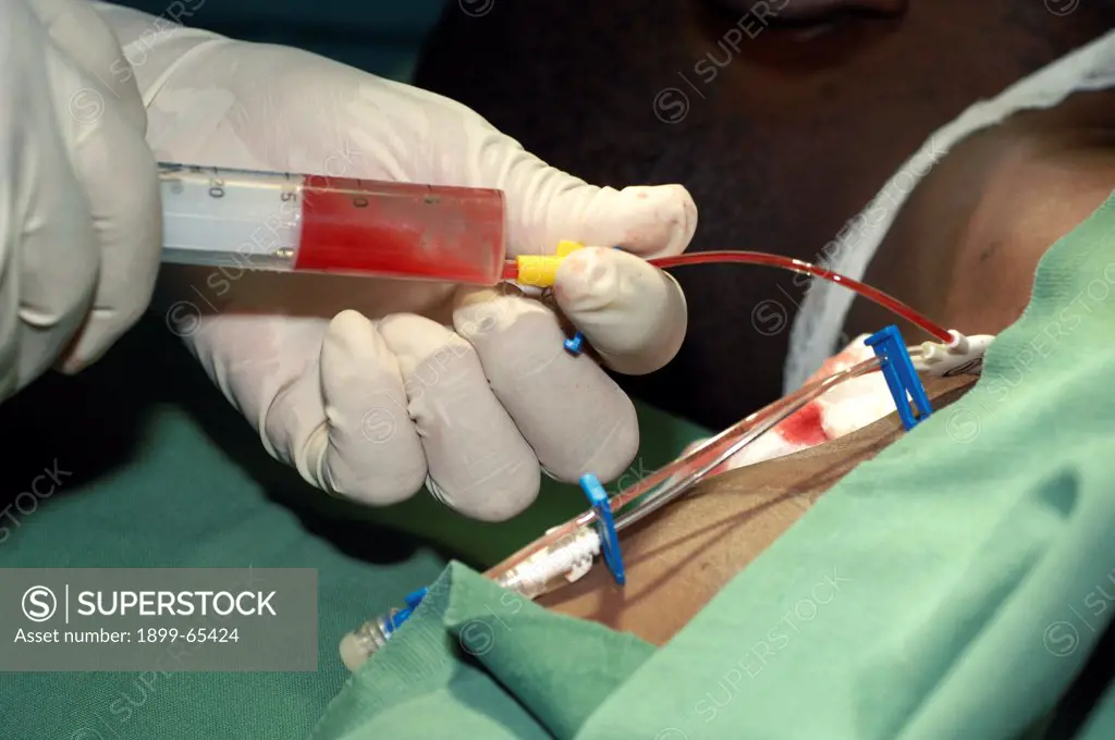 Central Venous Catheter Insertion