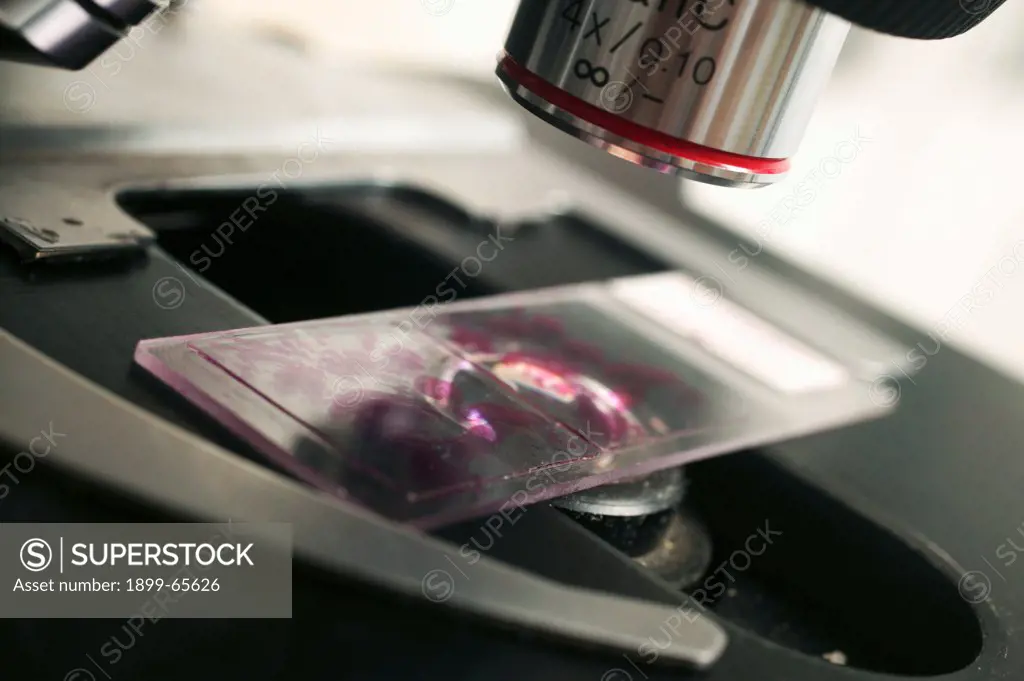 Microscope cytology sample slide