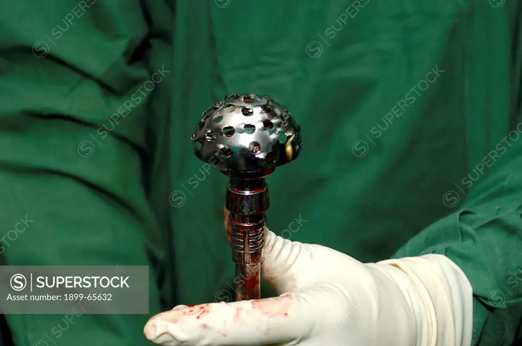 Surgeon holding grated head of drill reamer during