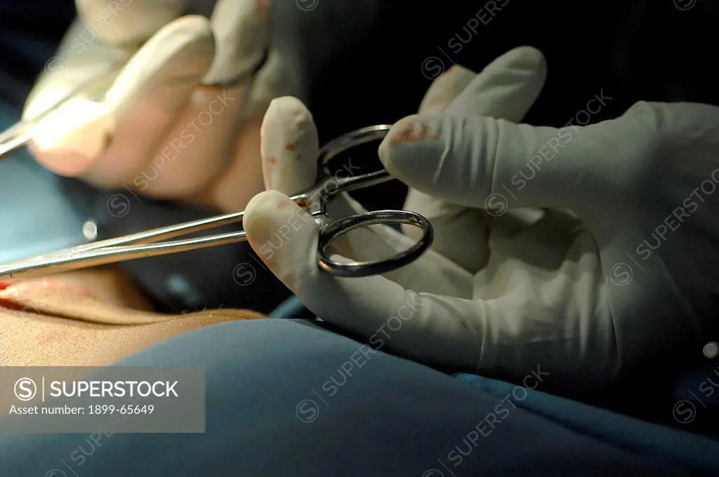 Gloved hands of surgeon holding pair of forceps above