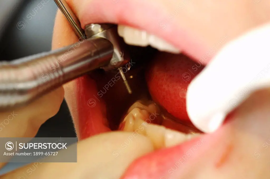 Dentist inspecting boys mouth before treatment
