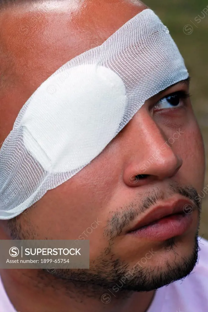 Man wearing eye patch