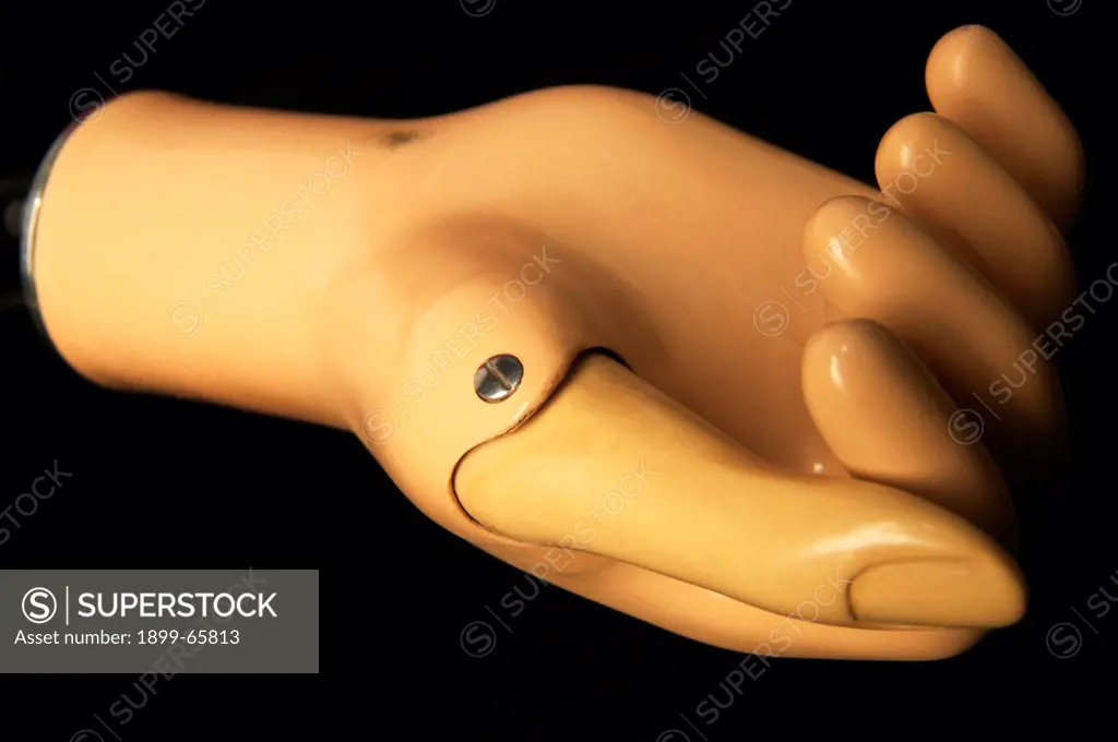 Prosthetic steeplon hand