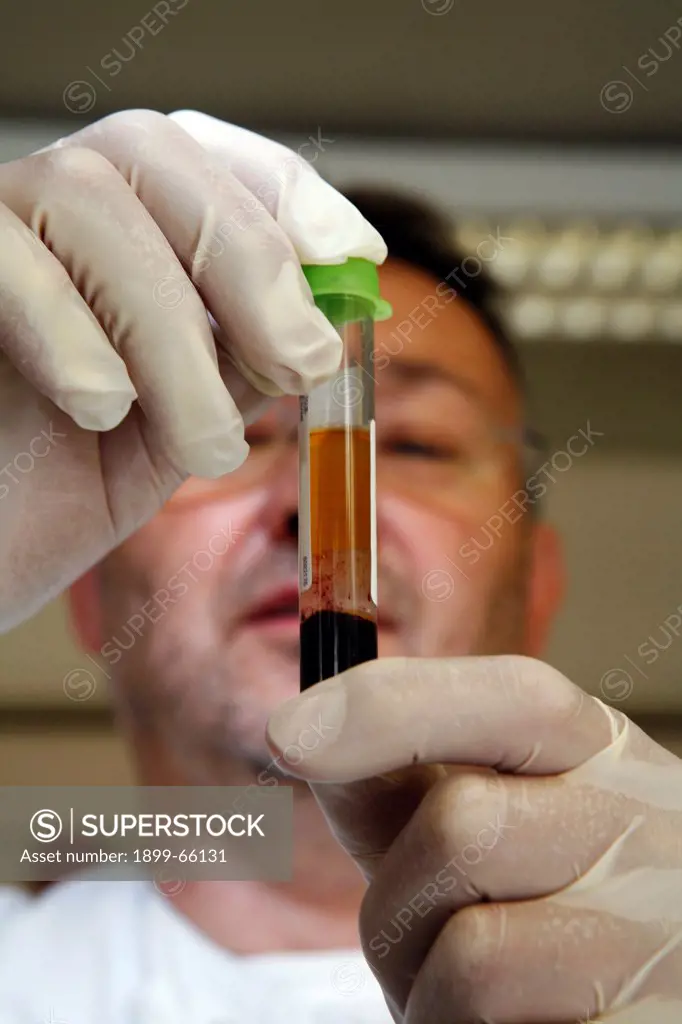 Pathologist analyzing blood sample contained in phial