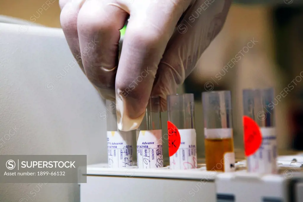 Hand inserting glass vials in rack holder