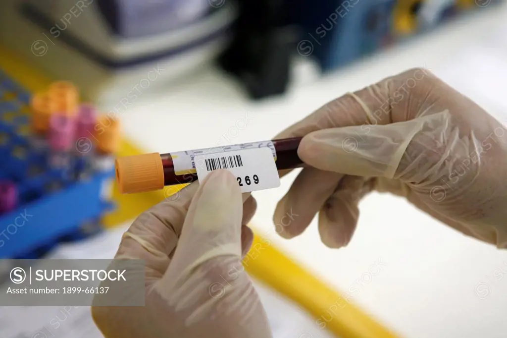 Pathologist labeling blood samples in test tube