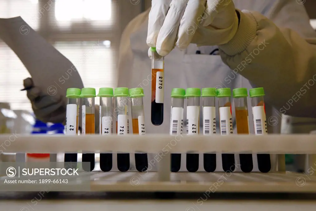 Pathologist organizing blood sample onto test tube holder