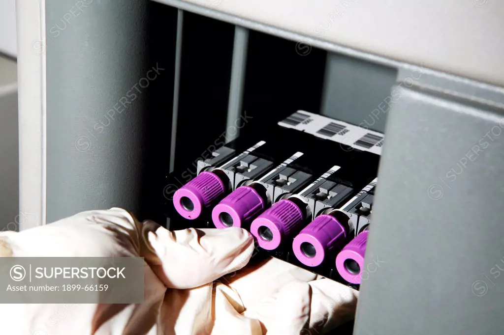 Laboratory technician removing bar coded blood specimens