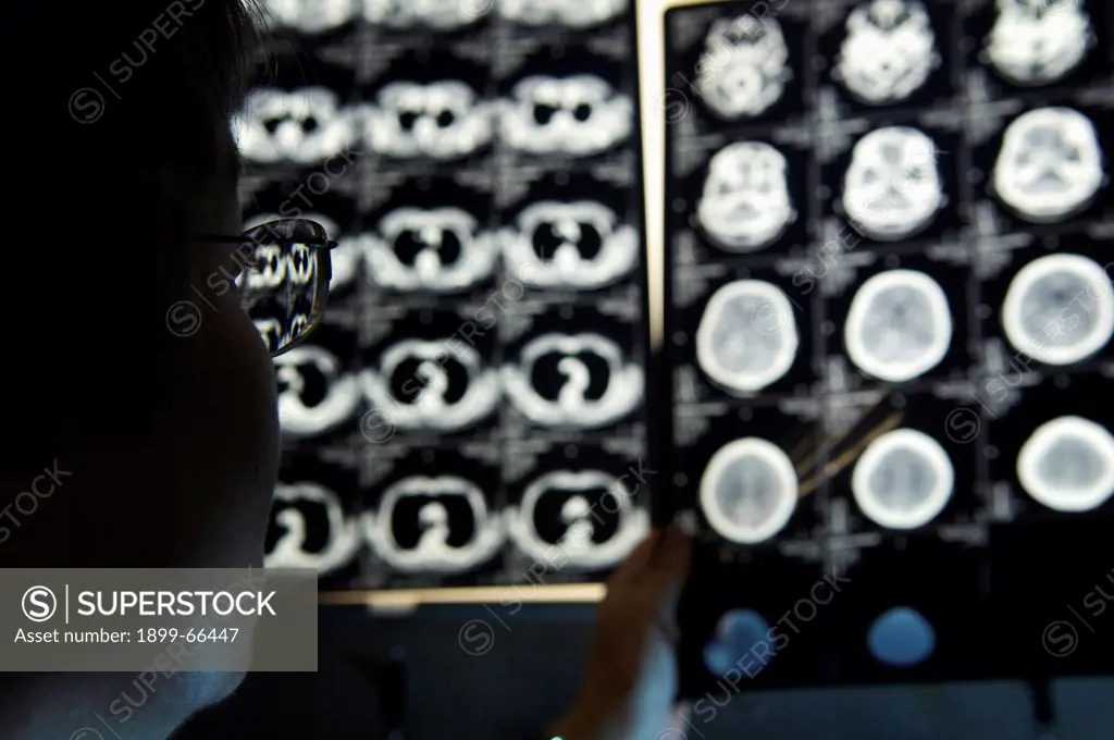 Radiologist examining various CT scans