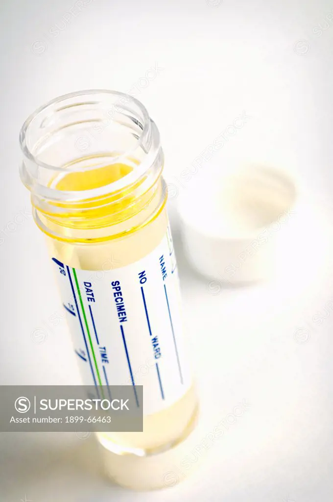 Studio shot of urine sample