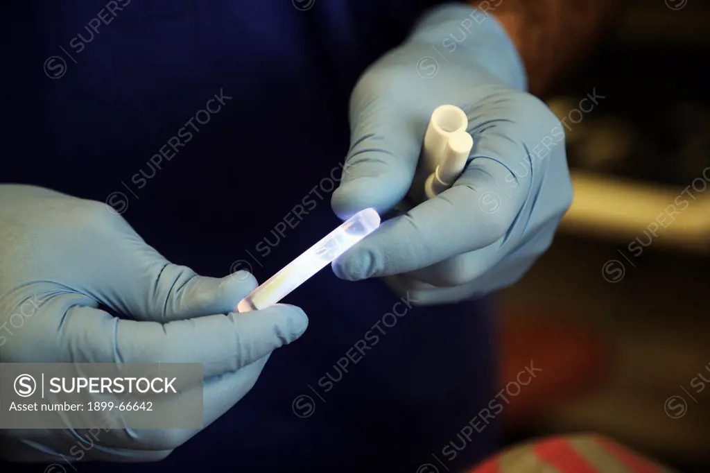 Hands of dental specialist holding light wand used