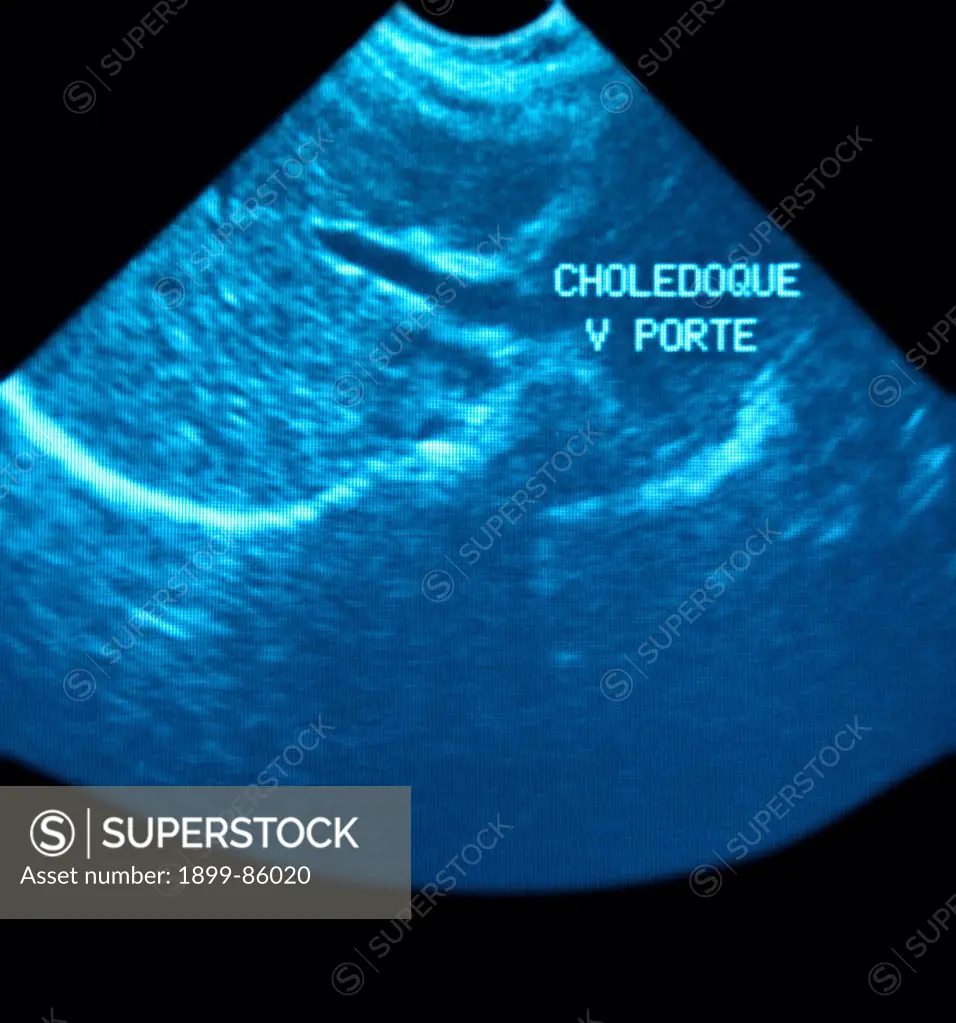 Common Bile Duct Ultrasound Scan
