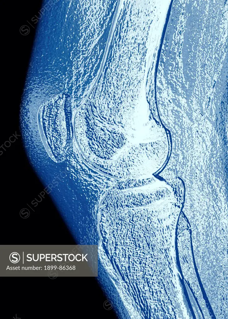 Knee scan