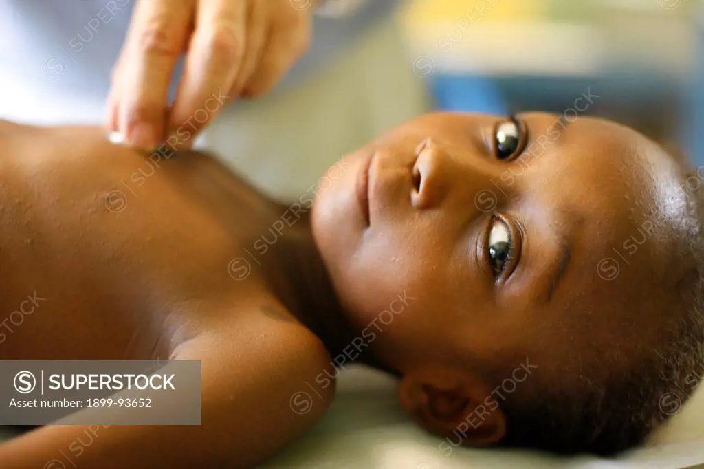 Haitian child with a cardiac malformation, Haiti,06/05/2010