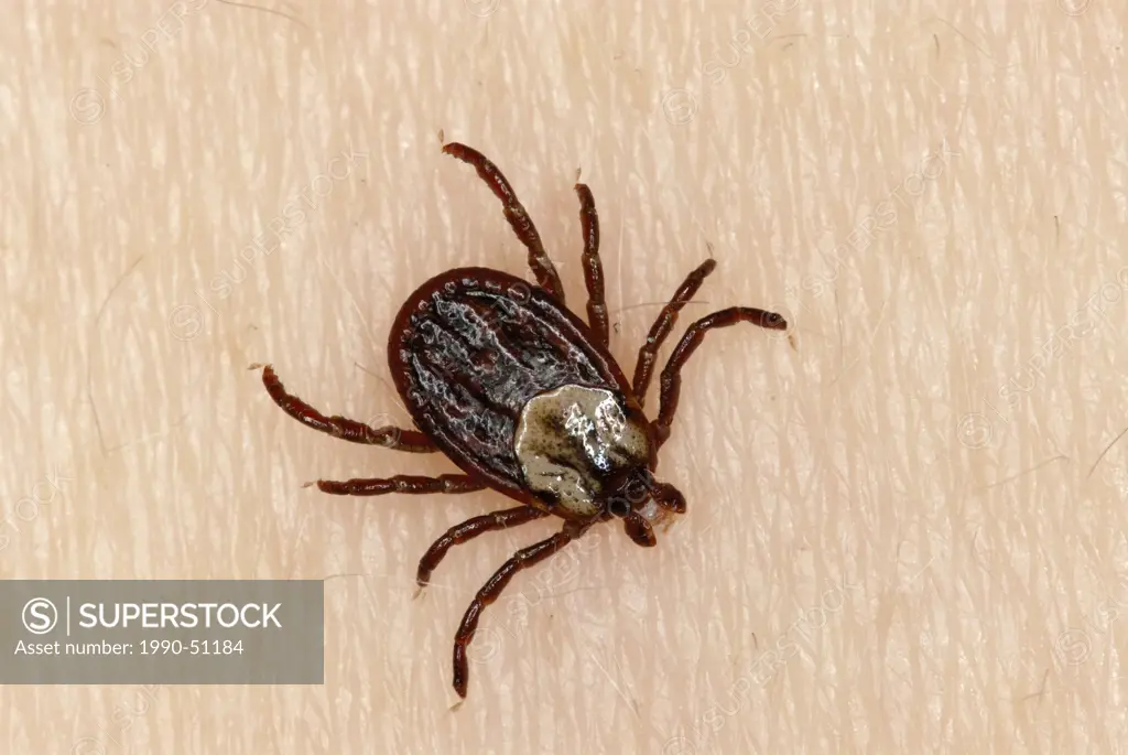 Wood Tick Dermacentor variabilis on person´s skin, Ontario, Canada