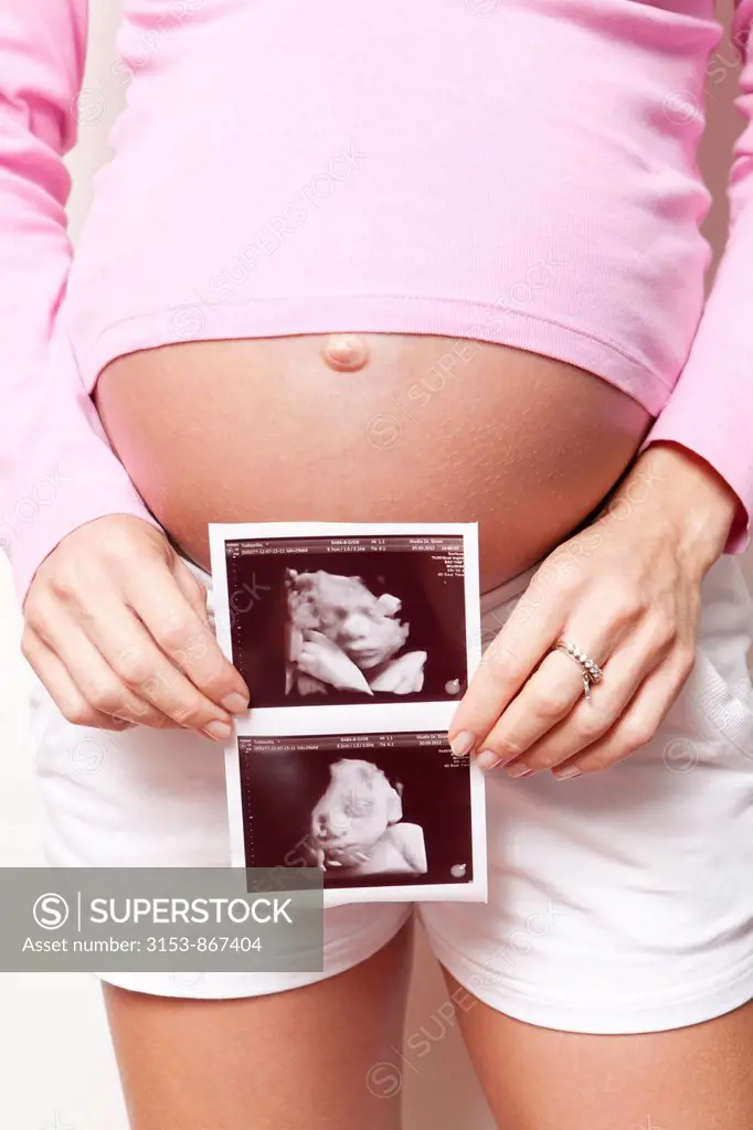 donna incinta con ecografia morfologica