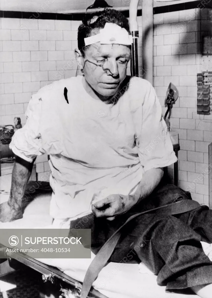 James Peck, bleeding on a hospital gurney in Birmingham, Alabama, following attack on a 'Freedom Riders' bus. May 14, 1961.