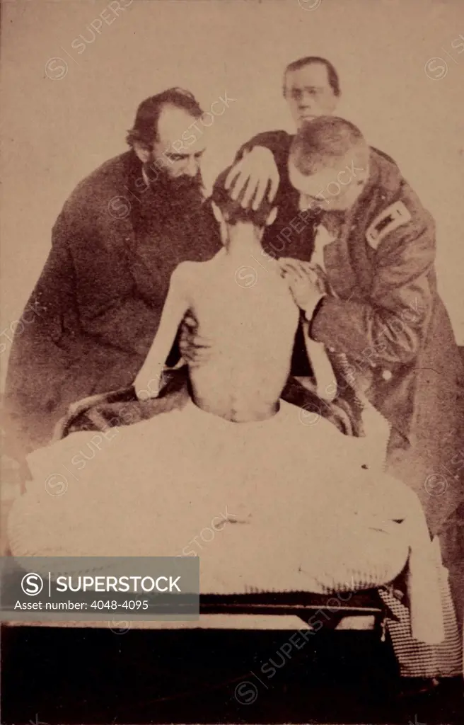 The Civil War, Doctors examining a Federal prisoner returned from prison, photograph circa 1861-1865.