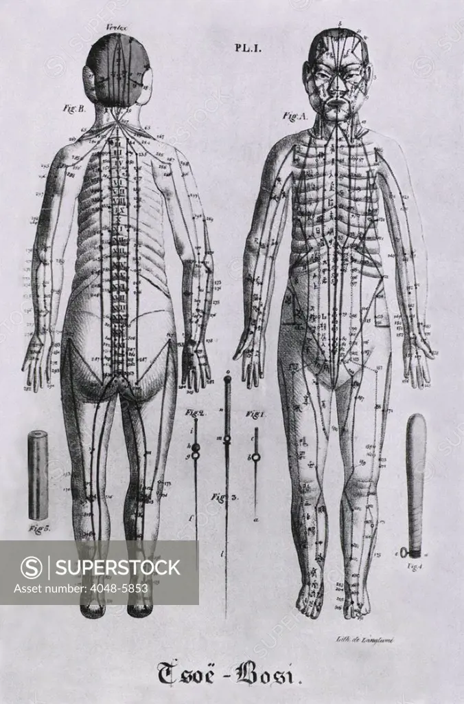 Front and back views of a human figure with numerous acupuncture points and meridians identified. Between the figures, but not to scale, are three acupuncture needles. Illustration from a 1825 French book on Chinese acupuncture by Jean Baptiste Sarlandiere.