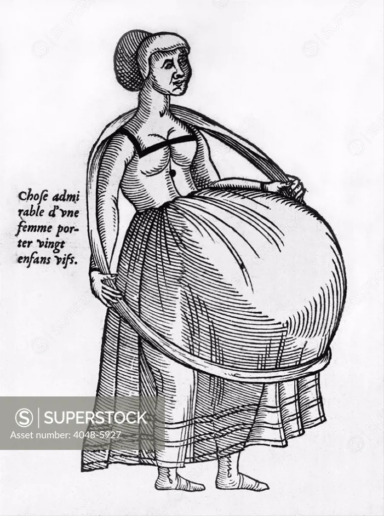 Pregnant woman using a hoop to support burgeoning womb. Illustration from a medical text by Ambrose Pare, the great French surgeon, 1575.
