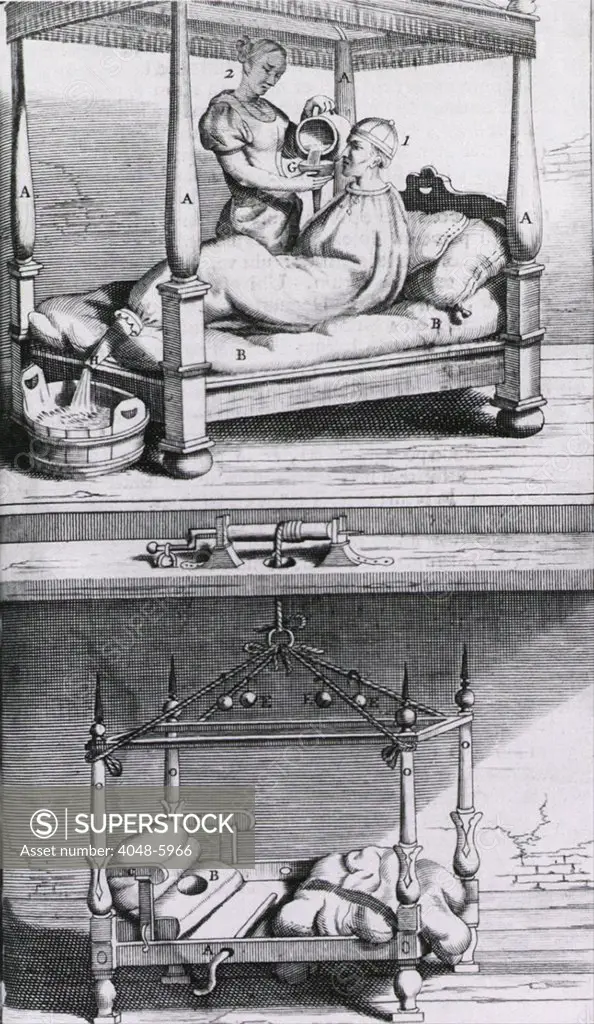 Fever Bag of the 17th century. At top a women prepares to pour cold water in to the bag at the patient's neck, which will cool the fevered patient before it empties in the a bucket at the foot of the bed. European engraving of 1672.
