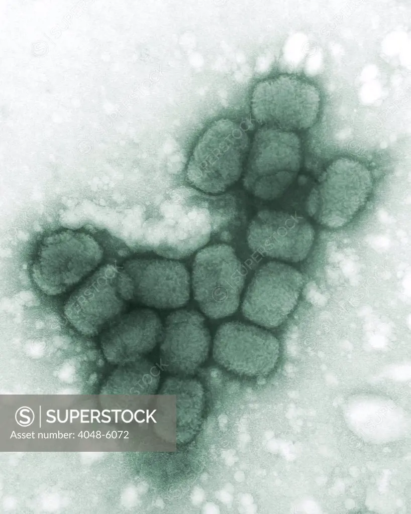 Smallpox viruses. A colorized transmission electron micrograph. 1975.