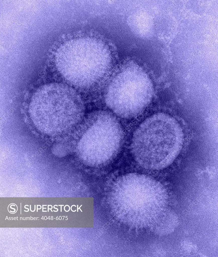 Swine flu virus. Negative stained transmission electron micrograph. Photo by C. S. Goldsmith and A. Balish, 2009.