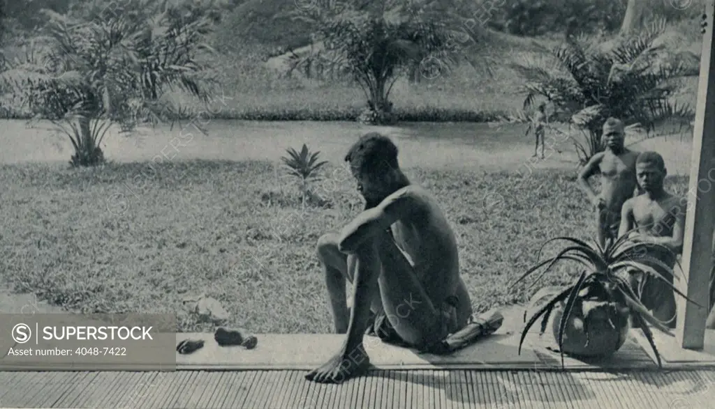 Atrocities of the Rubber Slavery in the Belgian Congo. Grief stricken man lost his wife and two children to soldiers who killed and cannibalized them in a random attack on his village. After the attack, villagers recovered the hand and foot of his five year old daughter.